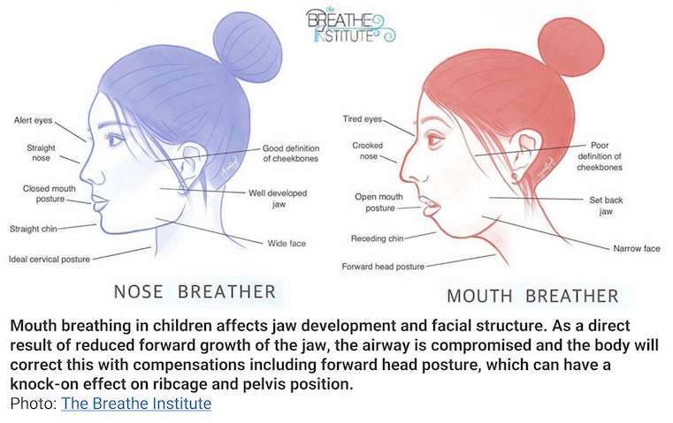 A photo explaining the difference between a nose breather and a mouth breather